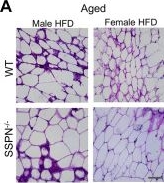 Fig.6.A showing Immunohistochemistry in a Mus musculus (House mouse) sample from the publication: Aging reveals a sex-dependent susceptibility of sarcospan-deficient mice to cardiometabolic disease.