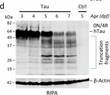 Fig.4.D showing Western Blotting in a Danio rerio (Zebrafish) sample from the publication: A human Tau expressing zebrafish model of progressive supranuclear palsy identifies Brd4 as a regulator of microglial synaptic elimination.