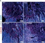 Fig.2.A showing Immunohistochemistry in a Mus musculus (House mouse) sample from the publication: Inhibiting DPP4 in a mouse model of HHT1 results in a shift towards regenerative macrophages and reduces fibrosis after myocardial infarction.