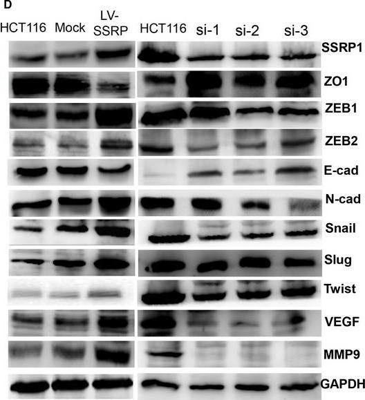 Fig.3.D showing Western Blotting in a Homo sapiens (Human) sample from the publication: SSRP1 promotes colorectal cancer progression and is negatively regulated by miR-28-5p.