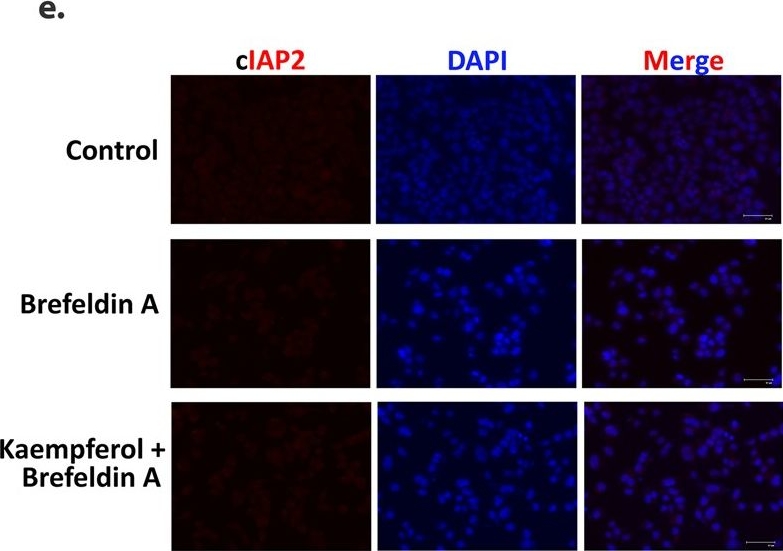 Fig.4.E showing Immunocytochemistry-immunofluorescence in a Homo sapiens (Human) sample from the publication: Kaempferol mitigates Endoplasmic Reticulum Stress Induced Cell Death by targeting caspase 3/7.