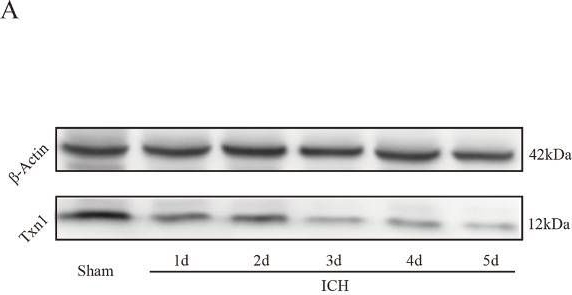Fig.1.A showing Western Blotting in a Rattus norvegicus (Rat) sample from the publication: Thioredoxin1 Binding Metastasis-Associated Lung Adenocarcinoma Transcript 1 Attenuates Inflammation and Apoptosis after Intracerebral Hemorrhage.