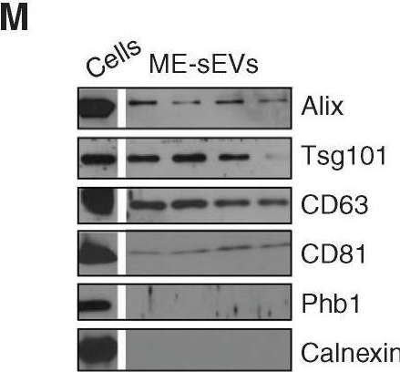 Fig.1.M showing Western Blotting from the publication: Extracellular Vesicle Secretion by Leukemia Cells In Vivo Promotes CLL Progression by Hampering Antitumor T-cell Responses.