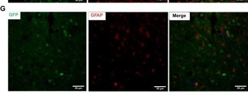 Fig.4.G showing Immunohistochemistry-immunofluorescence from the publication: Sonic Hedgehog Signaling Promotes Survival and Lineage Specific Differentiation of Transplanted Neural Precursor Cells and Improves Motor Recovery After Thoracic Spinal Cord Injury in Rats.