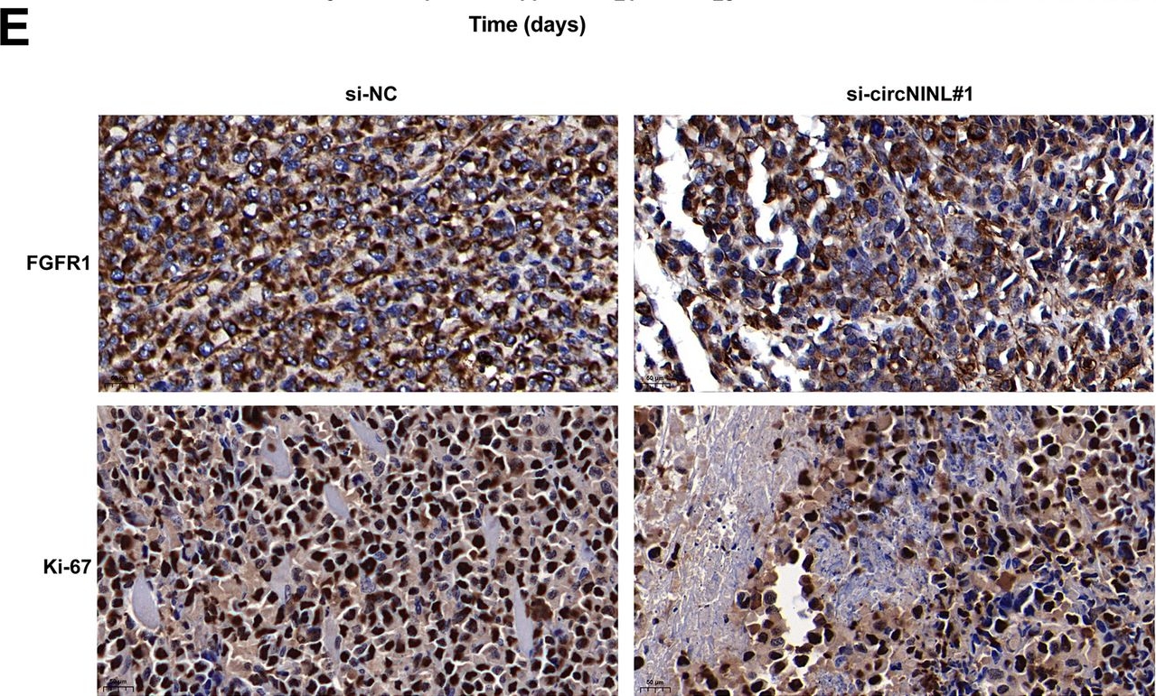Fig.7.E showing Immunohistochemistry from the publication: circNINL facilitates aerobic glycolysis, proliferation, invasion, and migration in lung cancer by sponging miR-3918 to mediate FGFR1 expression.