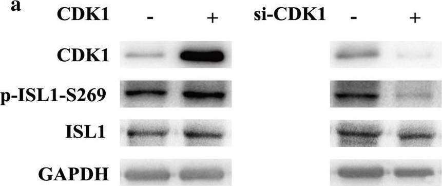 Fig.3.A showing Western Blotting from the publication: Phosphorylation of islet-1 serine 269 by CDK1 increases its transcriptional activity and promotes cell proliferation in gastric cancer.