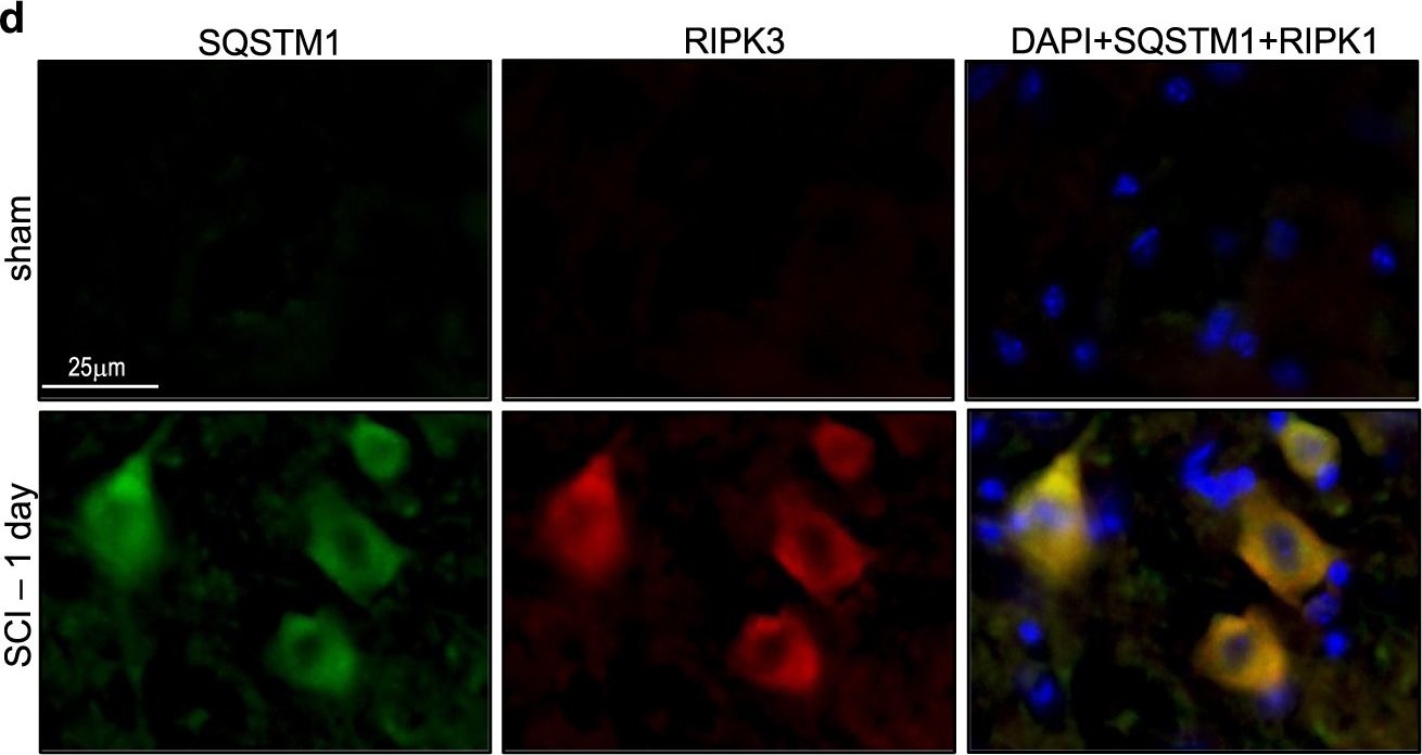 Lysosomal damage after spinal cord injury causes accumulation of RIPK1 and RIPK3 proteins and potentiation of necroptosis.