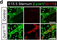 Fig.1.D showing Immunohistochemistry in a Mus musculus (House mouse) sample from the publication: Epigenetic priming by Dot1l in lymphatic endothelial progenitors ensures normal lymphatic development and function.