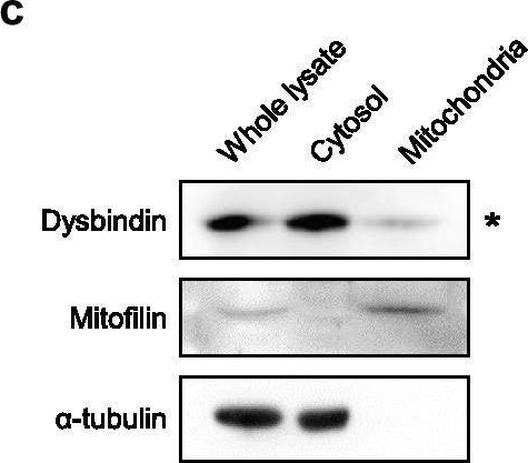 Fig.2.C showing Western Blotting in a Mus musculus (House mouse) sample from the publication: Schizophrenia-associated dysbindin modulates axonal mitochondrial movement in cooperation with p150glued.