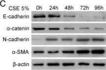 Fig.4.C showing Western Blotting in a Homo sapiens (Human) sample from the publication: The role of uPAR in epithelial-mesenchymal transition in small airway epithelium of patients with chronic obstructive pulmonary disease.