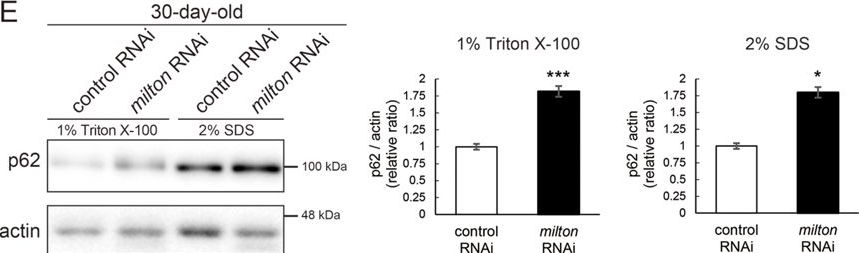 Fig.2.E showing Western Blotting from the publication: Axonal distribution of mitochondria maintains neuronal autophagy during aging via eIF2β.