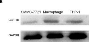 Fig.1.B showing Western Blotting in a Homo sapiens (Human) sample from the publication: Ultrasound Molecular Imaging as a Potential Non-invasive Diagnosis to Detect the Margin of Hepatocarcinoma via CSF-1R Targeting.