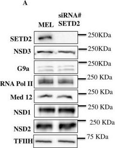 Fig.7.A showing Western Blotting from the publication: Histone methyltransferase G9a crosstalks with H3K36 histone methyltransferases NSD3 and SETD2 to mediate gene activation.