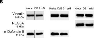 Fig.4.B showing Western Blotting from the publication: Human intestinal bitter taste receptors regulate innate immune responses and metabolic regulators in obesity.