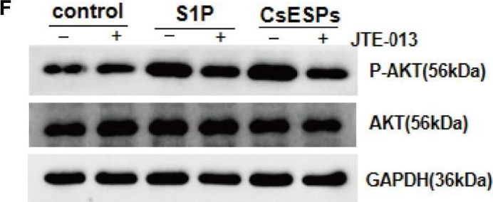 Fig.8.F showing Western Blotting from the publication: Clonorchis sinensis infection induces hepatobiliary injury via disturbing sphingolipid metabolism and activating sphingosine 1-phosphate receptor 2.