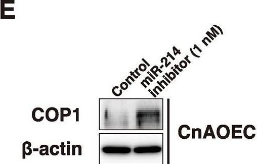 Fig.4.E showing Western Blotting from the publication: MicroRNA-214 Promotes Apoptosis in Canine Hemangiosarcoma by Targeting the COP1-p53 Axis.