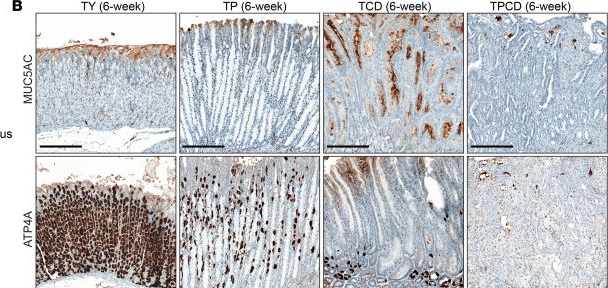 Fig.3.B showing Immunohistochemistry in a Mus musculus (House mouse) sample from the publication: Loss of Kmt2c/d promotes gastric cancer and confers vulnerability to mTORC1 and PD-1 inhibition.