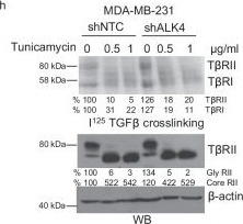Fig.5.H showing Western Blotting from the publication: Loss of ALK4 promotes cancer progression through regulating TGF-β receptor N-glycosylation.