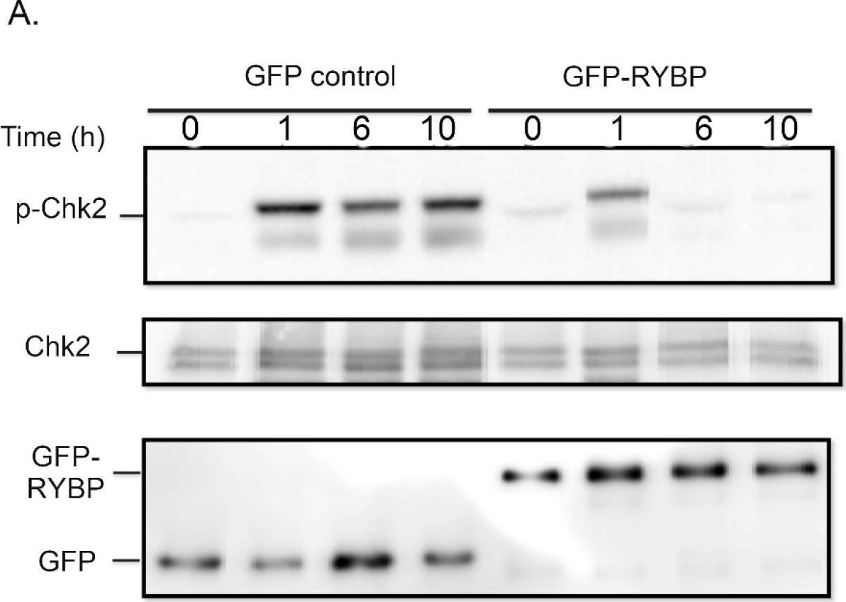 Fig.2.A showing Western Blotting in a Homo sapiens (Human) sample from the publication: RYBP Sensitizes Cancer Cells to PARP Inhibitors by Regulating ATM Activity.