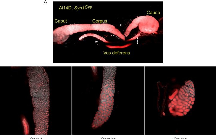 Fig.4.A from the publication: Evidence for RNA or protein transport from somatic tissues to the male reproductive tract in mouse.