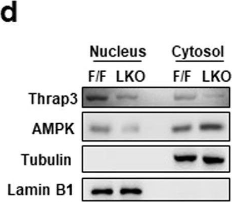 Fig.7.D showing Western Blotting in a Mus musculus (House mouse) sample from the publication: Thrap3 promotes nonalcoholic fatty liver disease by suppressing AMPK-mediated autophagy.