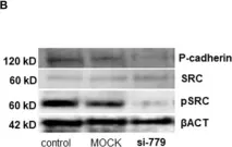 Fig.5.B showing Western Blotting from the publication: P-cadherin mutations are associated with high basal Wnt activity and stemness in canine mammary tumor cell lines.