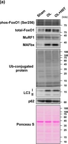 Fig.4.A showing Western Blotting from the publication: Combined effects of mechanical overload and high-intensity interval training on skeletal muscle hypertrophy in male mice.