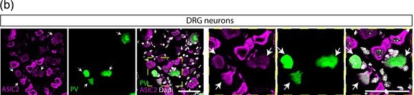 Fig.1.B showing Immunohistochemistry-immunofluorescence in a Mus musculus (House mouse) sample from the publication: The mechanosensitive ion channel ASIC2 mediates both proprioceptive sensing and spinal alignment.