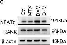 Fig.2.G showing Western Blotting in a Mus musculus (House mouse) sample from the publication: Methotrexate inhibits glucocorticoids-induced osteoclastogenesis via activating IFN-γR/STAT1 pathway in the treatment of rheumatoid arthritis.