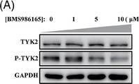 Fig.4.A showing Western Blotting in a Homo sapiens (Human) sample from the publication: Topical TYK2 inhibitor ameliorates psoriasis-like dermatitis via the AKT-SP1-NGFR-AP1 pathway in keratinocytes.