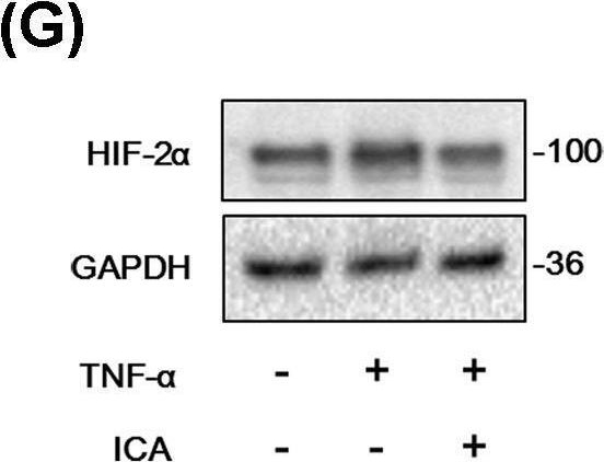 Fig.3.G showing Western Blotting from the publication: Icariin inhibits the inflammation through down-regulating NF-κB/HIF-2α signal pathways in chondrocytes.