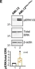 Fig.5.E showing Western Blotting in a Homo sapiens (Human) sample from the publication: An acquired scaffolding function of the DNAJ-PKAc fusion contributes to oncogenic signaling in fibrolamellar carcinoma.