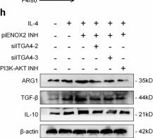 Fig.6.H showing Western Blotting from the publication: piENOX2 regulates ALKBH5-mediated Itga4 m6A modification to accelerate the progression of rheumatoid arthritis.