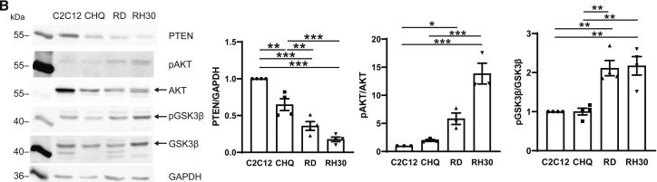 Fig.5.B showing Western Blotting from the publication: High level dynein impairs mitochondrial distribution and differentiation of rhabdomyosarcoma cells.