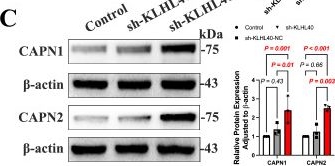 Fig.5.C showing Western Blotting from the publication: Post-infarction KLHL40-mediated regulation of cardiac sarcomeric integrity and function.