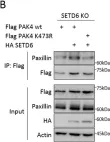 Fig.5.B showing Western Blotting in a Homo sapiens (Human) sample from the publication: PAK4 methylation by the methyltransferase SETD6 attenuates cell adhesion.