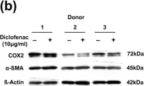 Fig.7.B showing Western Blotting in a Homo sapiens (Human) sample from the publication: The effect of the pro-inflammatory cytokine tumor necrosis factor-alpha on human joint capsule myofibroblasts.
