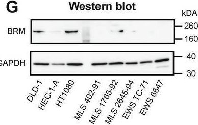 Fig.4.G showing Western Blotting from the publication: FET fusion oncoproteins enrich SWI/SNF complex subtypes and interaction partners.