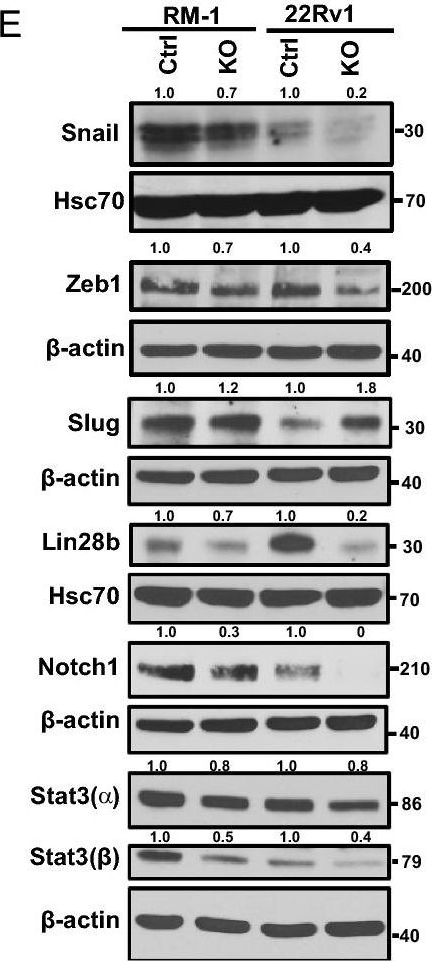 Fig.5.E showing Western Blotting from the publication: GD2 and its biosynthetic enzyme GD3 synthase promote tumorigenesis in prostate cancer by regulating cancer stem cell behavior.