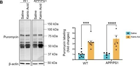 Fig.2.B from the publication: E3 Ubiquitin Ligase Nedd4-2 Exacerbates Seizure-Induced Mitochondrial Defects in an Alzheimer's Disease Mouse Model.