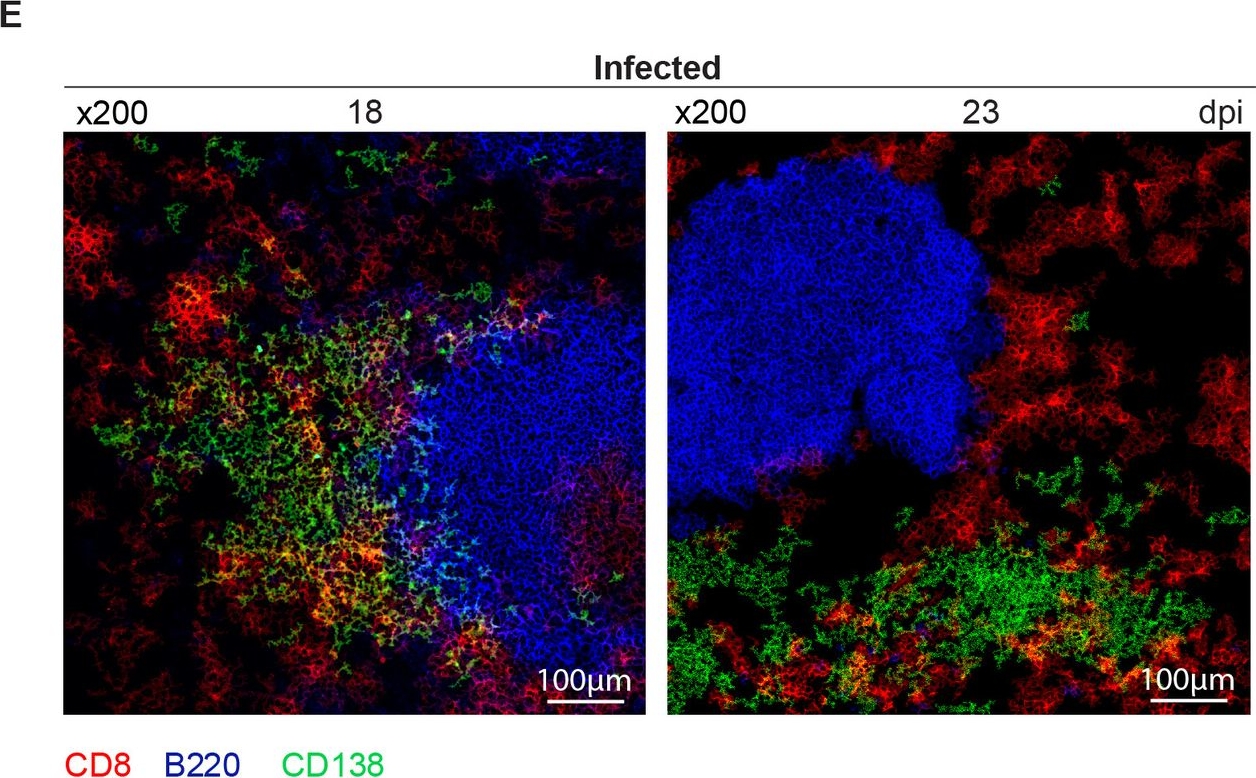 Fig.1.E showing Immunohistochemistry-immunofluorescence in a Mus musculus (House mouse) sample from the publication: Follicular CD8+ T cells in Trypanosoma cruzi infection: helpers or killers depending on the target B cell population.