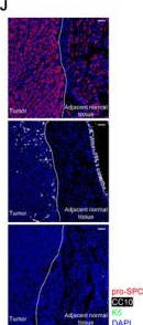 Fig.1.J showing Immunohistochemistry-immunofluorescence in a Mus musculus (House mouse) sample from the publication: CD103+ T Cells Eliminate Damaged Alveolar Epithelial Type II Cells Under Oxidative Stress to Prevent Lung Tumorigenesis.