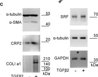 Fig.5.C showing Western Blotting from the publication: Significance of the p38MAPK-CRP2 axis in myofibroblastic phenotypic transition.