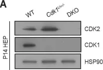 Fig.7.A showing Western Blotting from the publication: Loss of hepatocyte cell division leads to liver inflammation and fibrosis.