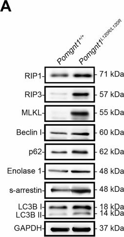 Fig.7.A showing Western Blotting in a Mus musculus (House mouse) sample from the publication: Glycosylation-driven necroptosis in retinal degeneration: dual rescue by AAV8 gene therapy and RIPK1 inhibition.