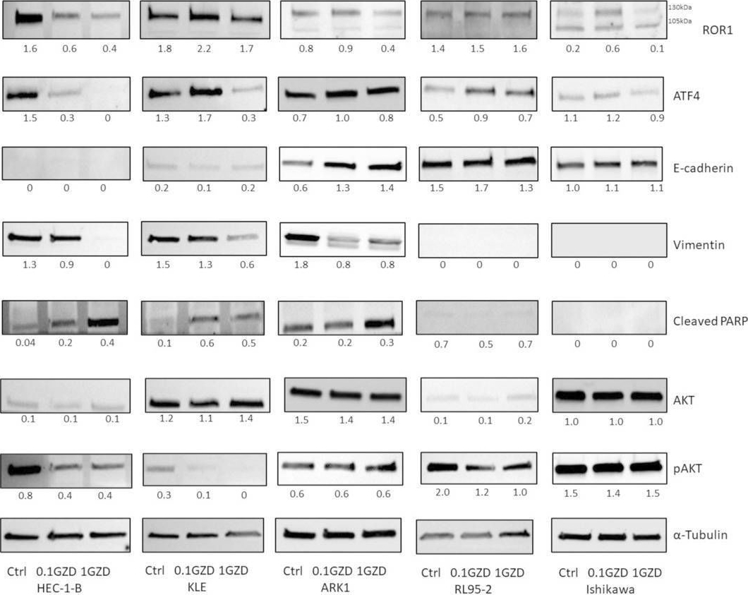 Fig.4.A showing Western Blotting in a Homo sapiens (Human) sample from the publication: The Multi-Kinase Inhibitor GZD824 (Olverembatinib) Shows Pre-Clinical Efficacy in Endometrial Cancer.