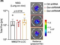 Fig.8.M from the publication: TGFβ induces an atypical EMT to evade immune mechanosurveillance in lung adenocarcinoma dormant metastasis.
