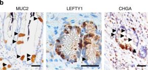 Lefty1 (D7E3G) Rabbit Monoclonal Antibody | Cell Signaling Technology