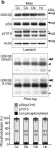 Fig.7.B showing Western Blotting from the publication: In vivo regulation of glycogen synthase kinase 3β activity in neurons and brains.