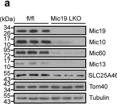 Fig.4.A showing Western Blotting in a Mus musculus (House mouse) sample from the publication: Mic19 depletion impairs endoplasmic reticulum-mitochondrial contacts and mitochondrial lipid metabolism and triggers liver disease.